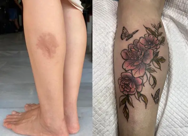 Scar Cover up tattoo