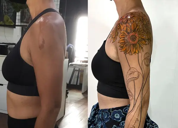 Scar Cover up tattoo