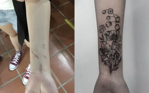 Scar Cover up tattoo